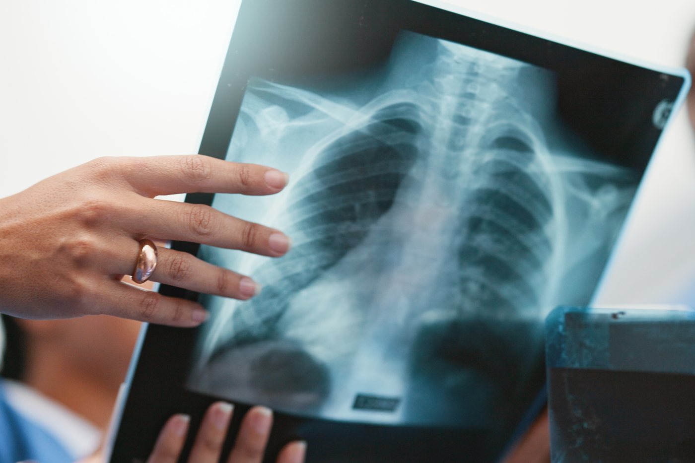 Results and follow-up: clinicians reviewing a chest X-ray together